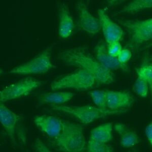 Human GGCT Antibody (FITC Conjugate)