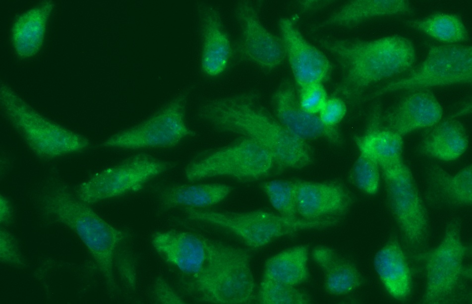 Human GGCT Antibody (FITC Conjugate)