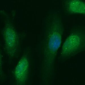 Human BDH2 Antibody (FITC Conjugate)