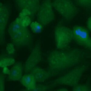 Human Carbonic Anhydrase 1 (CA1) Antibody (FITC Conjugate)