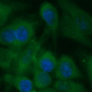 Human Troponin T (Cardiac) Antibody (FITC Conjugate)