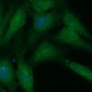 Human Annexin A7 (ANXA7) Antibody (FITC Conjugate)