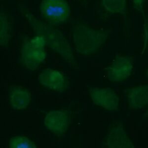 Human ASAM Antibody (FITC Conjugate)