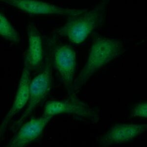 Human CD5 Antibody (FITC Conjugate)