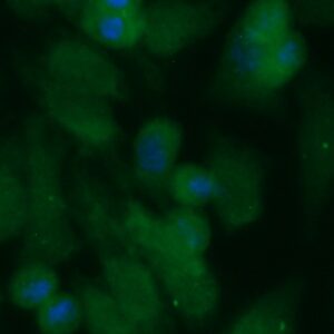 Human Cystatin-A (CSTA) Antibody (FITC Conjugate)
