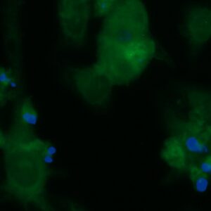 Human Fatty-Acid Amide Hydrolase 2 (FAAH2) Antibody (FITC Conjugate)
