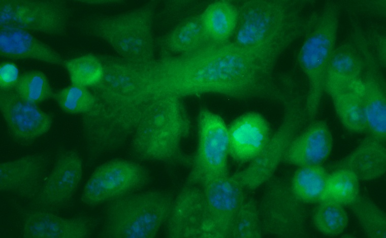 Human Carbonyl Reductase 3 (CBR3) Antibody (FITC Conjugate)
