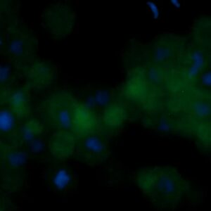 Human Elongation Factor 2 (EF-2) Antibody (FITC Conjugate)