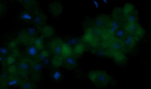 Human Elongation Factor 2 (EF-2) Antibody (FITC Conjugate)