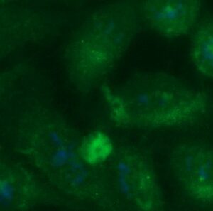 Human Mucin-1 (MUC-1, CA 15-3) Antibody (FITC Conjugate)