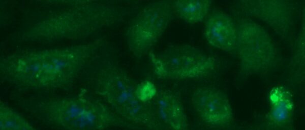 Human Mucin-1 (MUC-1, CA 15-3) Antibody (FITC Conjugate)
