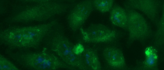 Human Mucin-1 (MUC-1, CA 15-3) Antibody (FITC Conjugate)