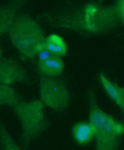 Human Alcohol Dehydrogenase 6 (ADH6) Antibody (FITC Conjugate) - Image 2