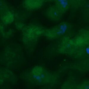 Human C-C Motif Chemokine 22 (MDC) Antibody (FITC Conjugate)