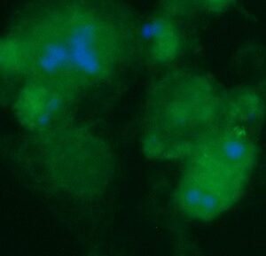 Human ATP6V1F Antibody (FITC Conjugate)