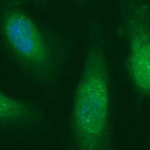 Human BDNF Antibody (FITC Conjugate)