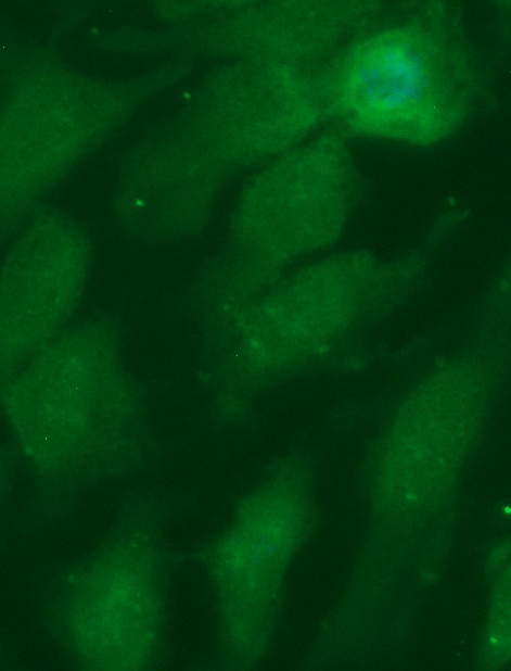 Human Cystatin-D (CST5) Antibody (FITC Conjugate)