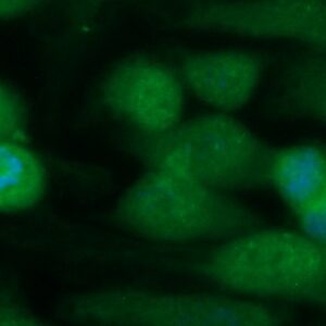 Human Cystatin-A (CSTA) Antibody (FITC Conjugate)