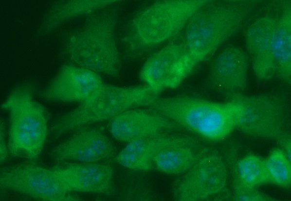 Human BRD3 Antibody (FITC Conjugate)