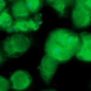 Human FOLR1 Antibody (FITC Conjugate)