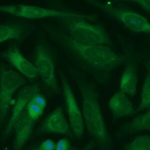 Human Calumenin Antibody (FITC Conjugate)