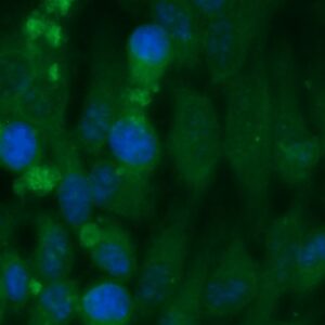 Human COMT Antibody (FITC Conjugate)