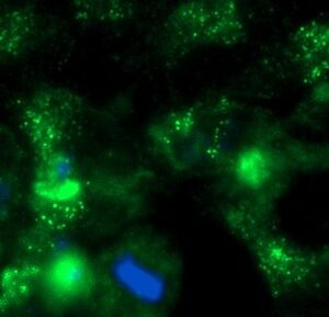 Human Stathmin-1 AssayLite Antibody (FITC Conjugate)