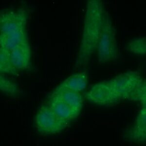 Human DNTTIP1 Antibody (FITC Conjugate)