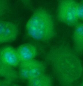 Human Aurora A Antibody (FITC Conjugate)