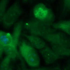 Human Aspartoacylase (ASPA) Antibody (FITC Conjugate)