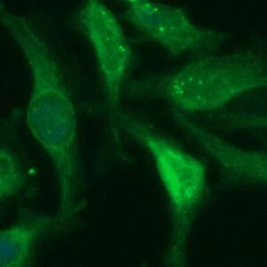 Human ACP6 Antibody (FITC Conjugate)