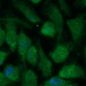 Human GMDS Antibody (FITC Conjugate)