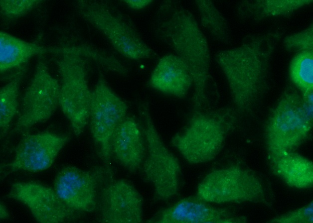 Human GMDS Antibody (FITC Conjugate)
