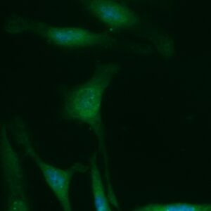 Human CBR1 Antibody (FITC Conjugate)