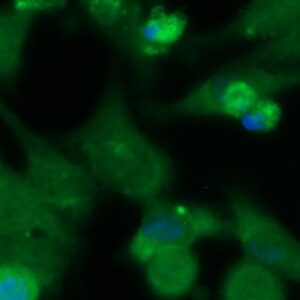 Human Ferritin Heavy Chain (FTH1) Antibody (FITC Conjugate)