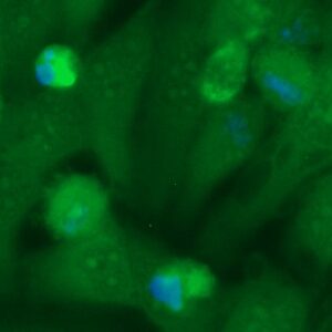Human BMP-7 Antibody (FITC Conjugate)