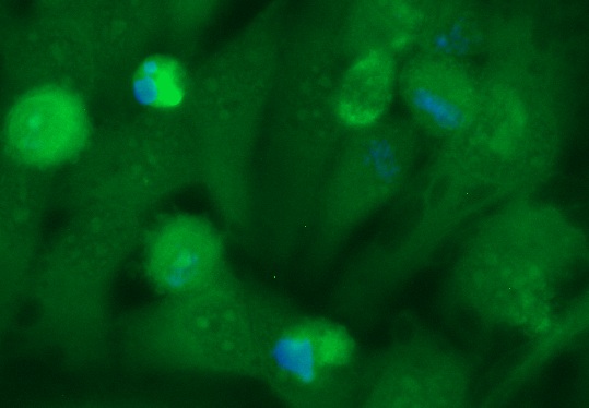 Human BMP-7 Antibody (FITC Conjugate)