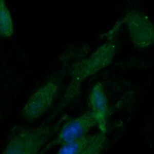 Human ALDH2 Antibody (FITC Conjugate)