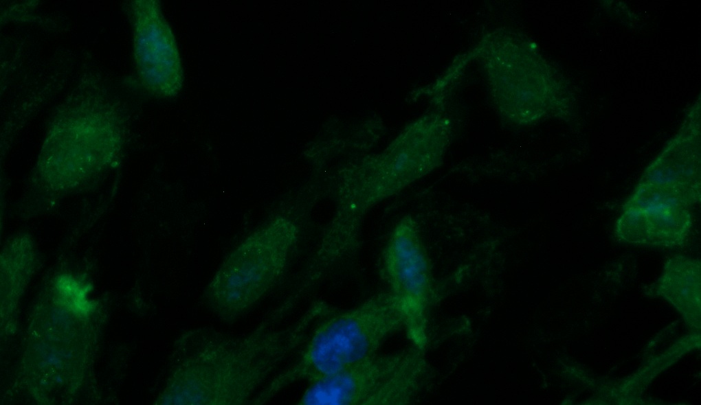 Human ALDH2 Antibody (FITC Conjugate)