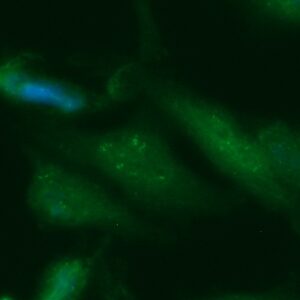 Human ADI1 Antibody (FITC Conjugate)