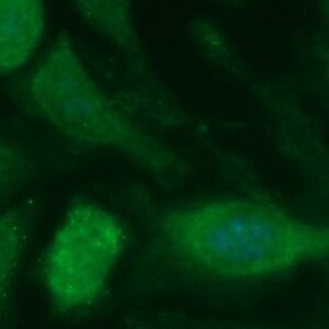 Human Alcohol Dehydrogenase 1C (ADH1C) Antibody (FITC Conjugate)