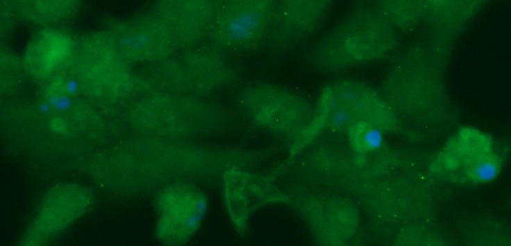 Human Alcohol Dehydrogenase 1A (ADH1A) Antibody (FITC Conjugate) - Image 2