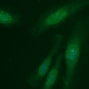 Human Carbonic Anhydrase 2 (CA2) Antibody (FITC Conjugate)