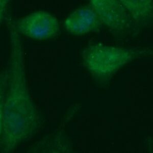 Human ADAL Antibody (FITC Conjugate)