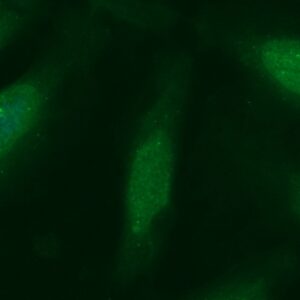 Human CCBL1 Antibody (FITC Conjugate)