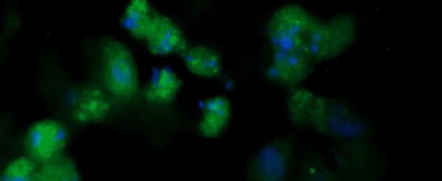Human PMP2 Antibody (FITC Conjugate)