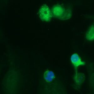 Human alpha B Crystallin Antibody (FITC Conjugate)