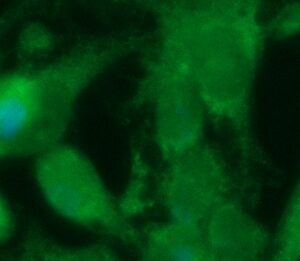 Human Ferritin Light Chain Antibody (FITC Conjugate)