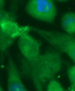 Human CRYGN Antibody (FITC Conjugate)