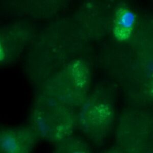 Human EIF3S2 Antibody (FITC Conjugate)